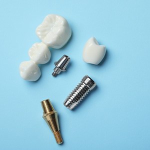 an assortment of dental implant parts